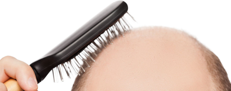 Hair Transplantation in Kolkata