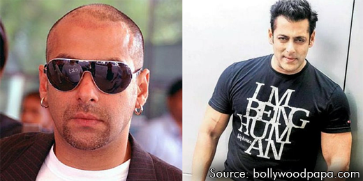 Did Salman Khan Undergo Hair Transplantation Surgery?