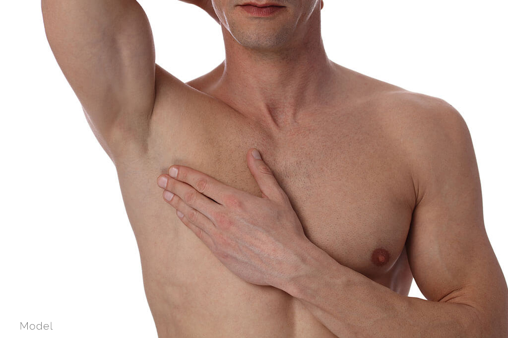 Male Boobs or Moobs: Basic Facts to Know about gynecomastia