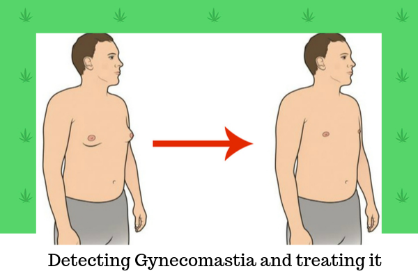 Detecting Gynecomastia and treating it