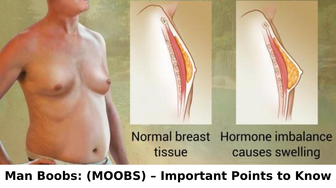 Man Boobs: (MOOBS) – Important Points to Know